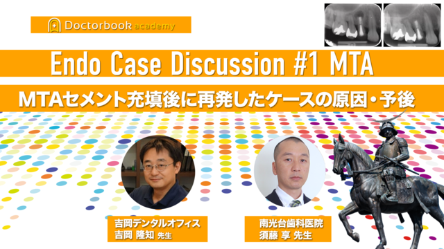 Endo Case Discussion #1.MTAセメント充填後に再発したケースの原因・予後を本音で語り合う【吉岡隆知先生✕須藤享先生】