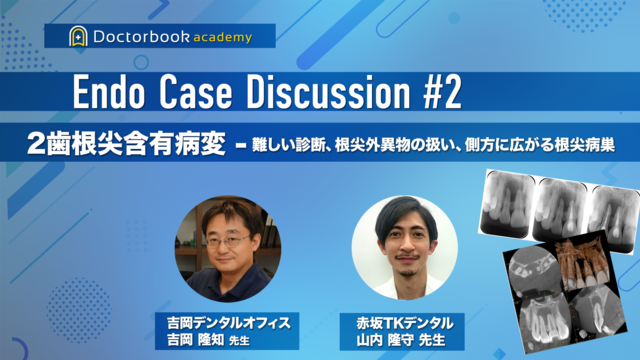 Endo Case Discussion #2. 2歯根尖含有病変の難しい診断、根尖外異物の扱い、側方に広がる根尖病巣について本音で語り合う【吉岡隆知先生✕山内隆守先生】