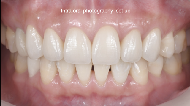 【GSC hands-on course】Intra oral photography set up
