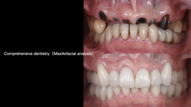【GSC hands-on course】Comprehensive dentistry（maxillofacial analysis）
