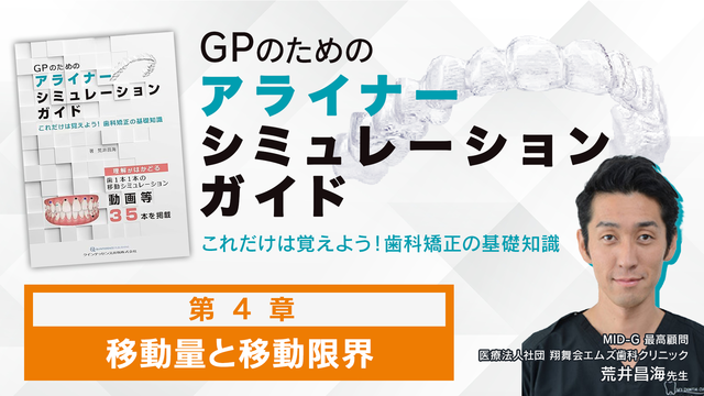 第4章 移動量と移動限界│GPのためのアライナーシミュレーションガイド ...