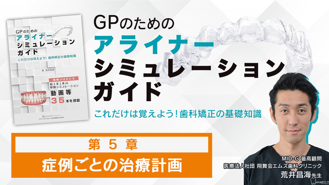 第5章 症例ごとの治療計画│GPのためのアライナーシミュレーション