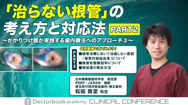 「治らない根管」の考え方と対応法 PART2 ～かかりつけ医が実践する歯内療法のアプローチ③～