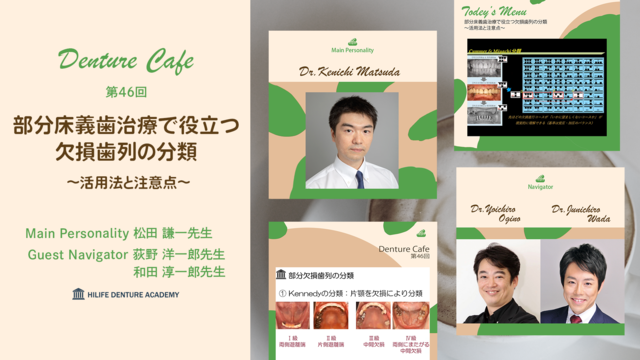 部分床義歯治療で役立つ欠損歯列の分類～活用法と注意点～│Denture Cafe 第46回