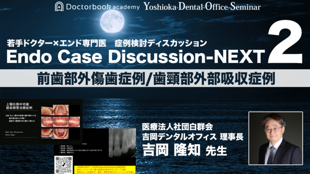 Endo Case Discussion NEXT - 若手ドクター×エンド専門医 症例ディスカッション - 第2回 前歯部外傷歯症例/外部吸収症例