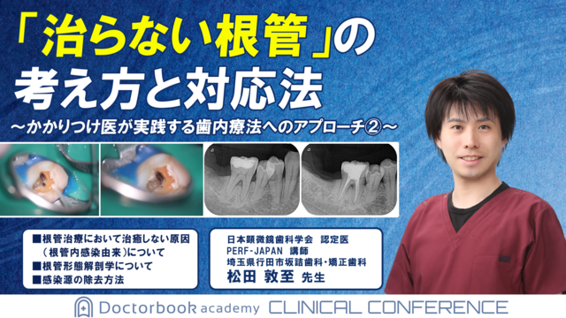 「治らない根管」の考え方と対応法 ～かかりつけ医が実践する歯内療法のアプローチ②～