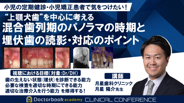 上顎犬歯を中心に考える 混合歯列期のパノラマの時期と埋伏歯の読影・対応のポイント