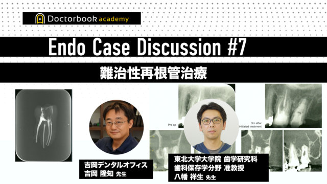 Book Rev.】臨床で困らない歯内療法の基礎 | Doctorbook academy 