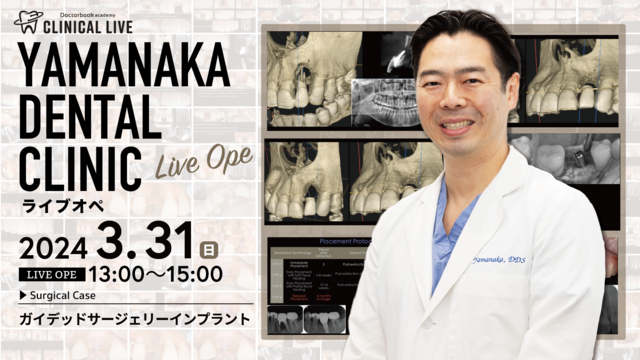 第7回　YAMANAKA DENTAL CLINIC ライブオペ　サイナスリフトを併用したガイデッドサージェリーインプラント