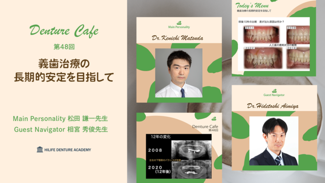 義歯治療の長期的安定を目指して│Denture Cafe 第48回