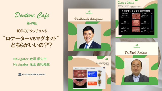 IODのアタッチメント、“ロケーターvsマグネット” どちらがいいの？？│Denture Cafe 第49回