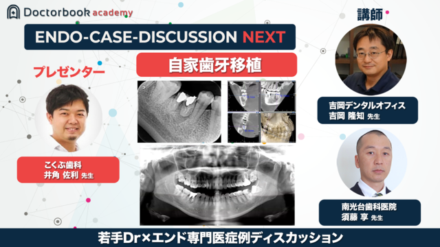 若手Dr×エンド専門医 Endo Case Discussion NEXT 自家歯牙移植