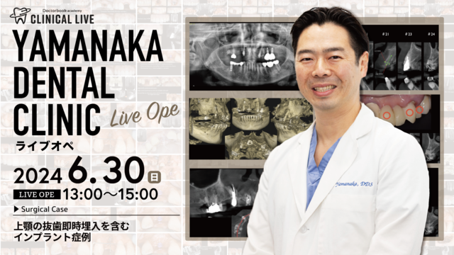 第8回　YAMANAKA DENTAL CLINIC ライブオペ　上顎の抜歯即時埋入を含むインプラント症例