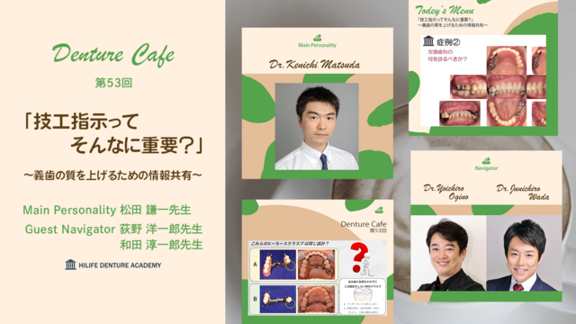 「技工指示ってそんなに重要？」 〜義歯の質を上げるための情報共有〜│Denture Cafe 第53回