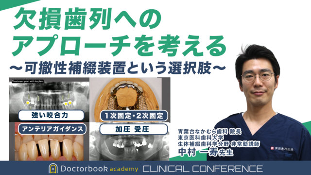 欠損歯列へのアプローチを考える 〜可撤性補綴装置という選択肢〜