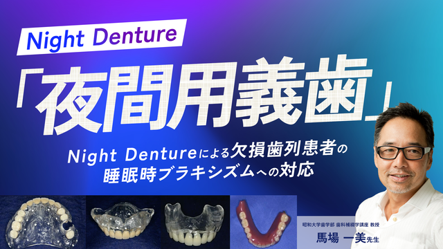 Night Dentureによる欠損歯列患者の睡眠時ブラキシズムへの対応