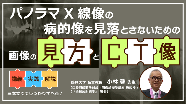 パノラマX線像の病的像を見落とさないための画像の見方とCT像