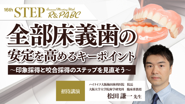すれ違い咬合に対しリジットな義歯で対応した症例 〜長く使える すれ違い咬合に対しリジットな義歯で対応した症例 〜長く使える