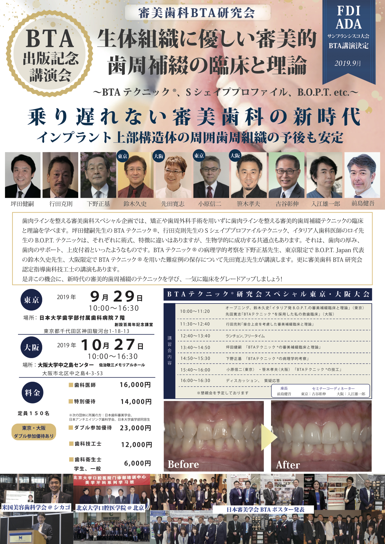 生体組織に優しい審美的歯周補綴 テクニックの臨床と理論 ～BTA