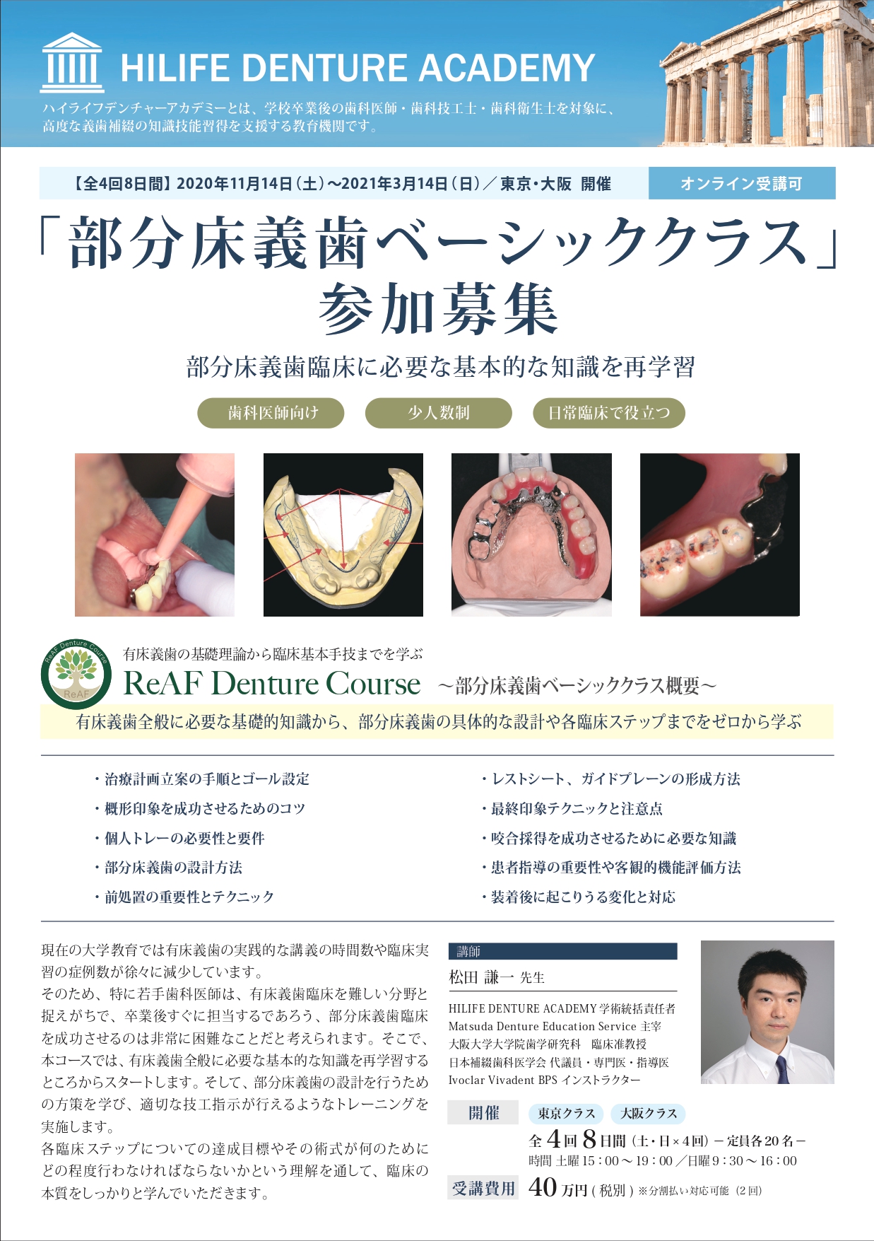 ～部分床義歯ベーシッククラス概要～　東京】ReAF　Denture　Course　Doctorbook　academy　(ドクターブックアカデミー)