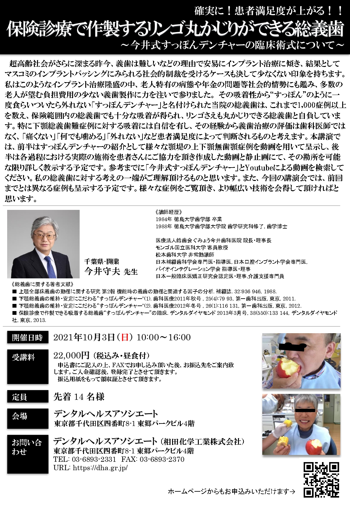 保険診療で作製するリンゴ丸かじりができる総義歯 今井式すっぽんデンチャーの臨床術式について Doctorbook Academy