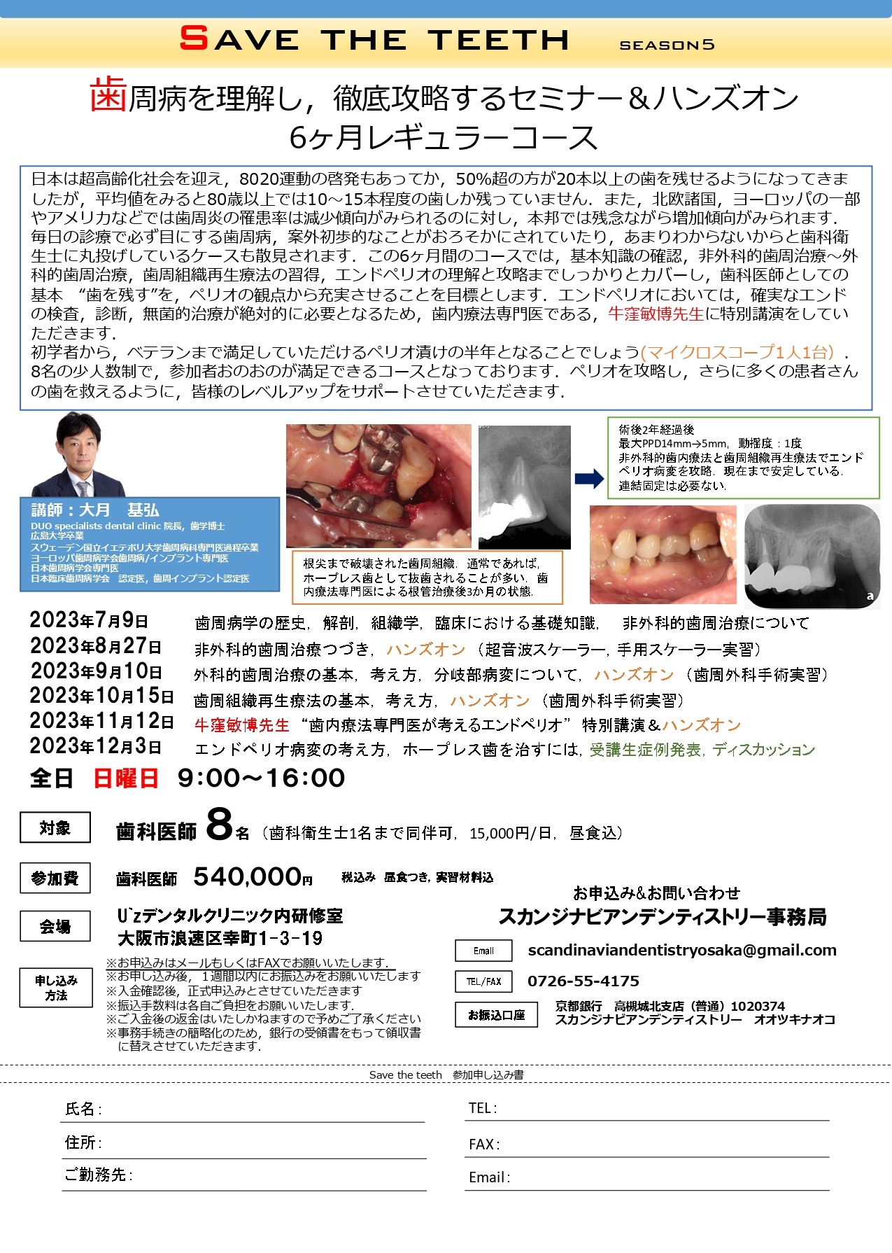 満員御礼】Save the teeth −Season5− 歯周病を理解し,徹底攻略する 