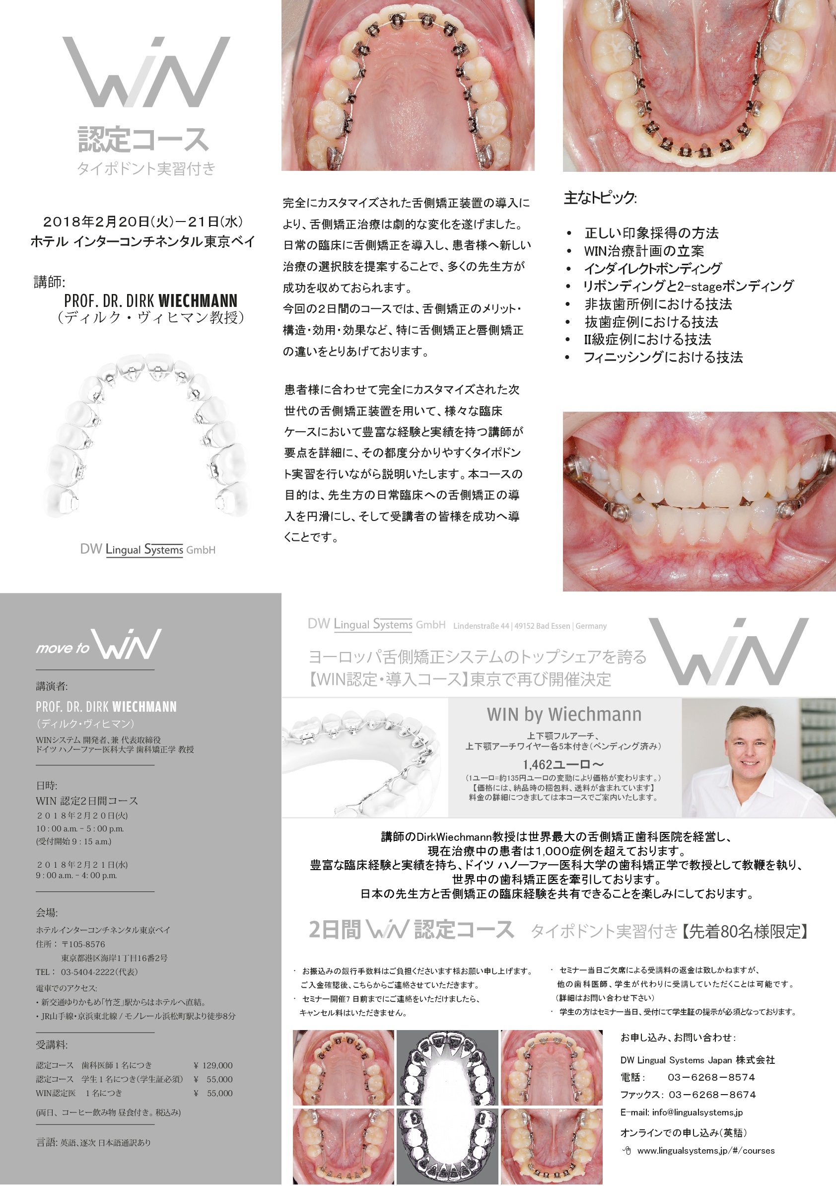 Muscle Wins の矯正歯科臨床呼吸および舌・咀嚼筋の機能を生かした治療