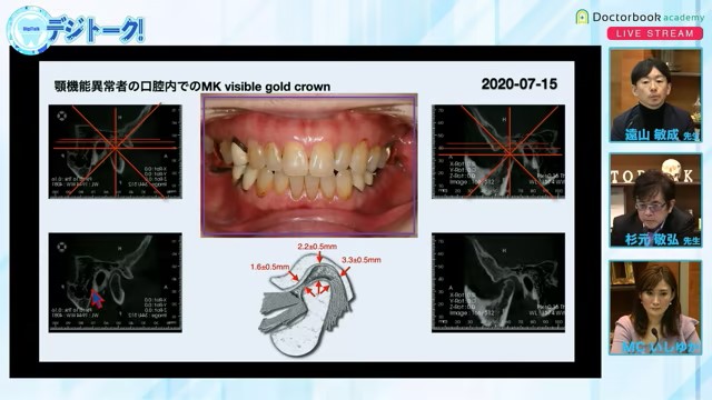 進化し続けるMulti-Digital Dentistryの歯科臨床：デジタルとアナログの接点編