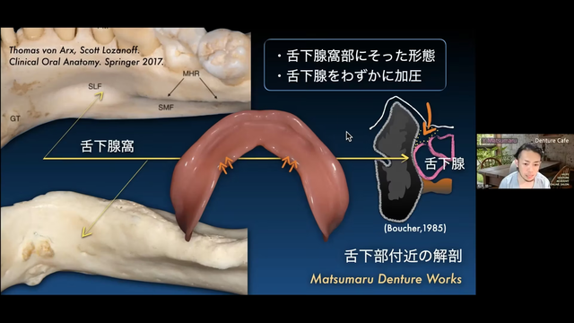 全部床義歯臨床に必要な解剖学を見直そう! Part3 〜下顎舌側の解剖 