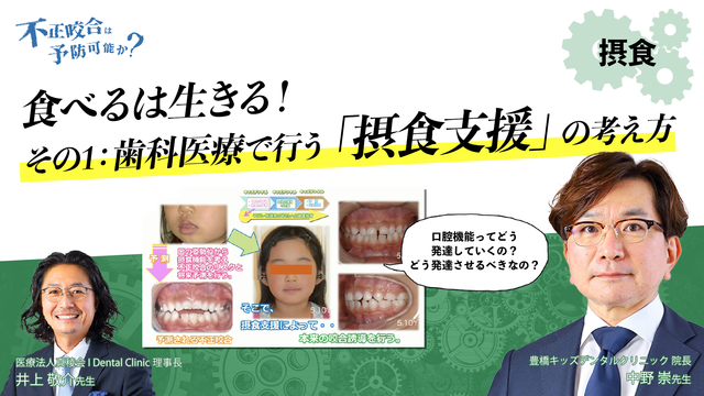 食べるは生きる！その1：歯科医療で行う摂食支援の考え方 井上 敬介先生、中野 崇先生