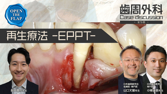 #1 EPPT - Entire papilla preservation techniqueを用いて歯周組織再生療法を行なった一症例