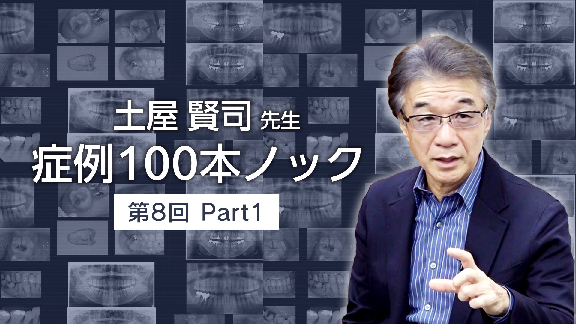 土屋賢司先生 症例100本ノック 第8回 PART1