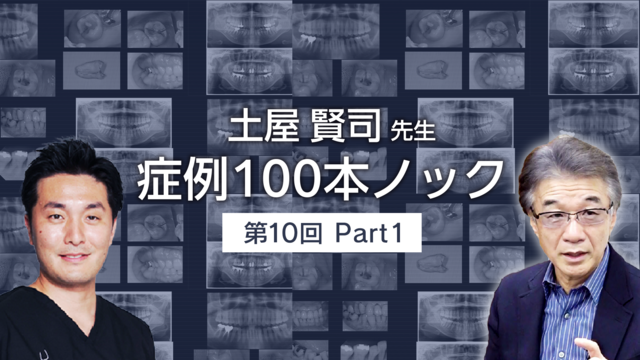 土屋賢司先生 症例100本ノック 第10回 PART1