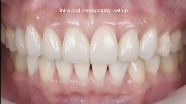 【GSC hands-on course】Intra oral photography set up 口腔内写真撮影 - 1day