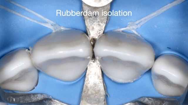  【GSC hands-on course】Rubber Dam Isolation start up ラバーダム防湿 - 1day