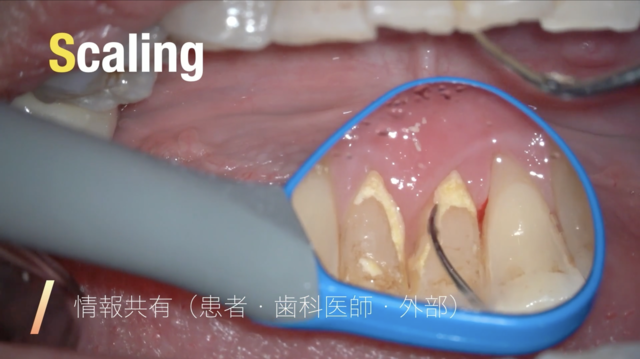 【GSC hands-on course】Micro hygienist