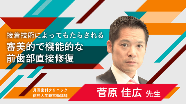 接着技術によってもたらされる審美的で機能的な前歯部直接修復