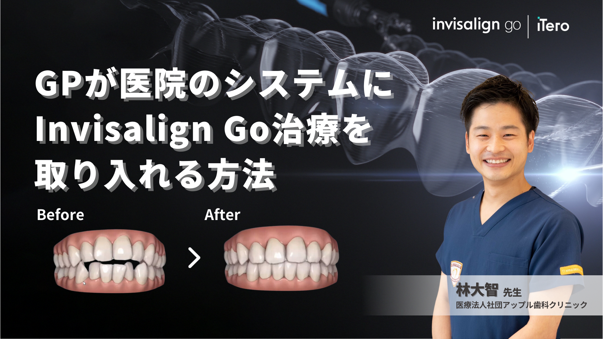 GPが医院のシステムにInvisalign Go治療を取り入れる方法