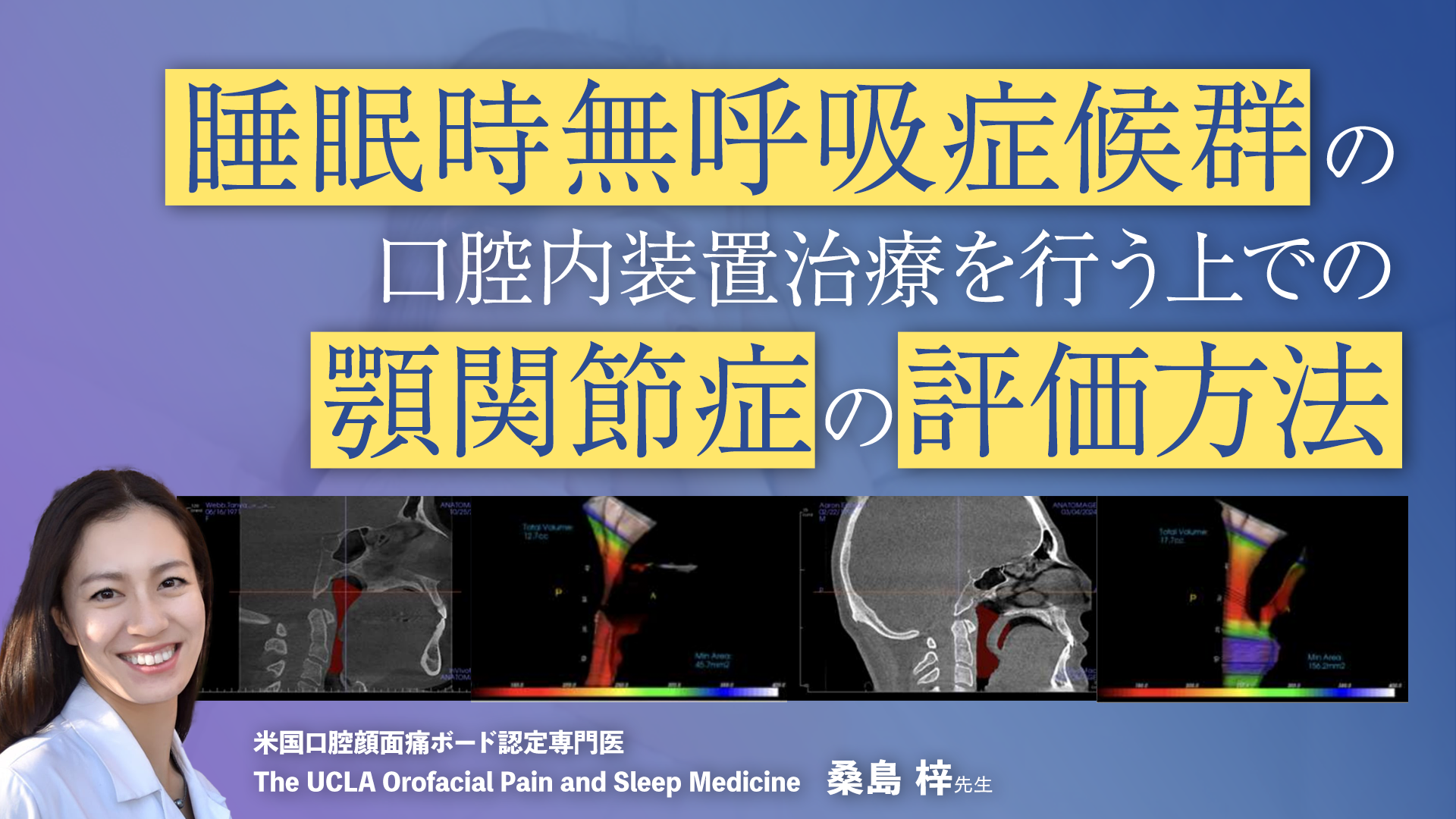 睡眠時無呼吸症候群の口腔内装置治療を行う上での顎関節症の評価方法