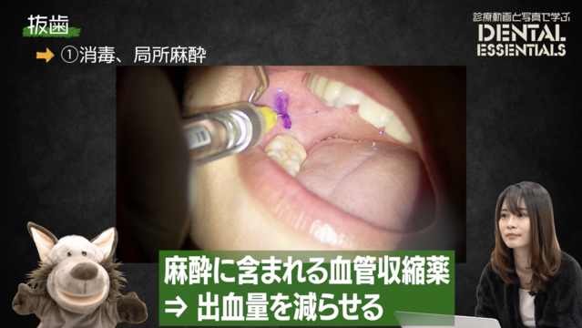 STEP1：消毒・局所麻酔│Dental Essentials vol.4 抜歯