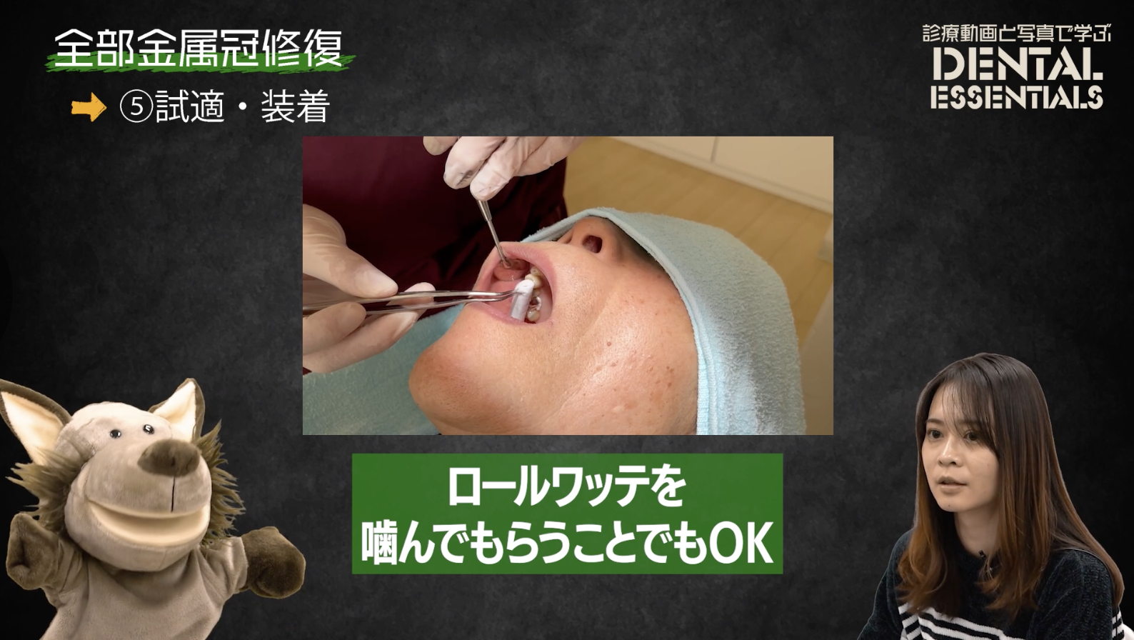 STEP5：試適・装着│Dental Essentials vol.5 全部金属冠