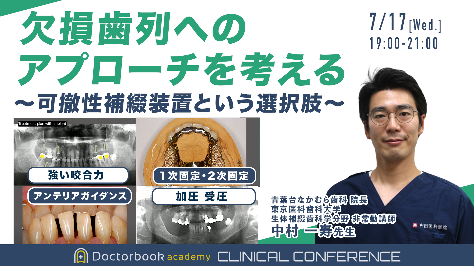 欠損歯列へのアプローチを考える 〜可撤性補綴装置という選択肢〜