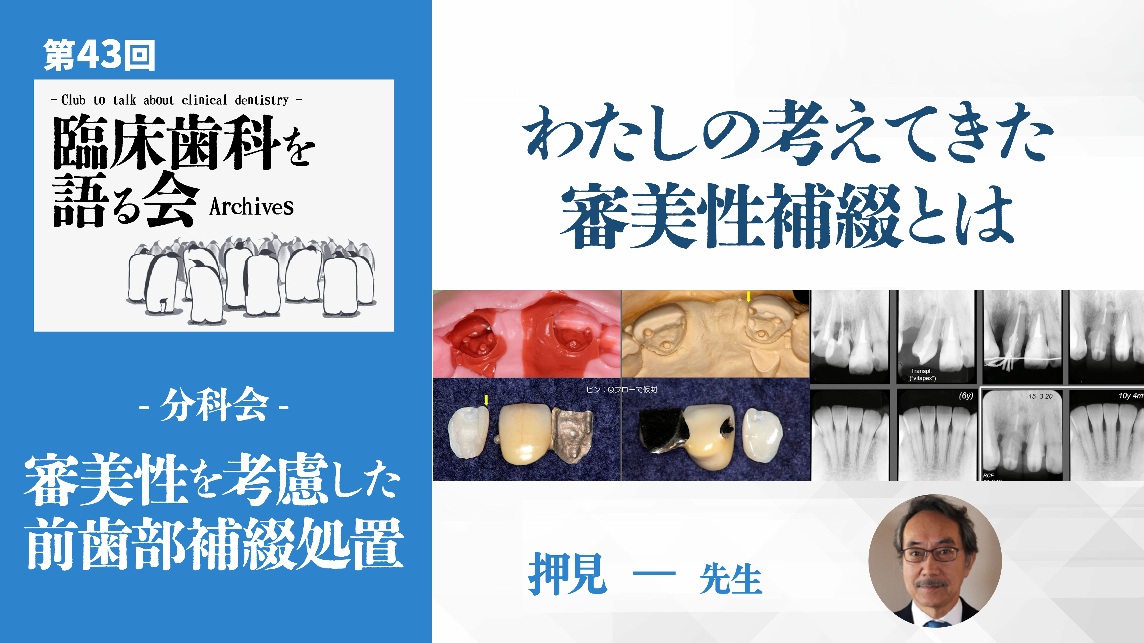 わたしの考えてきた審美性補綴とは 押見一先生【06/26-07/02 プレミアム化】