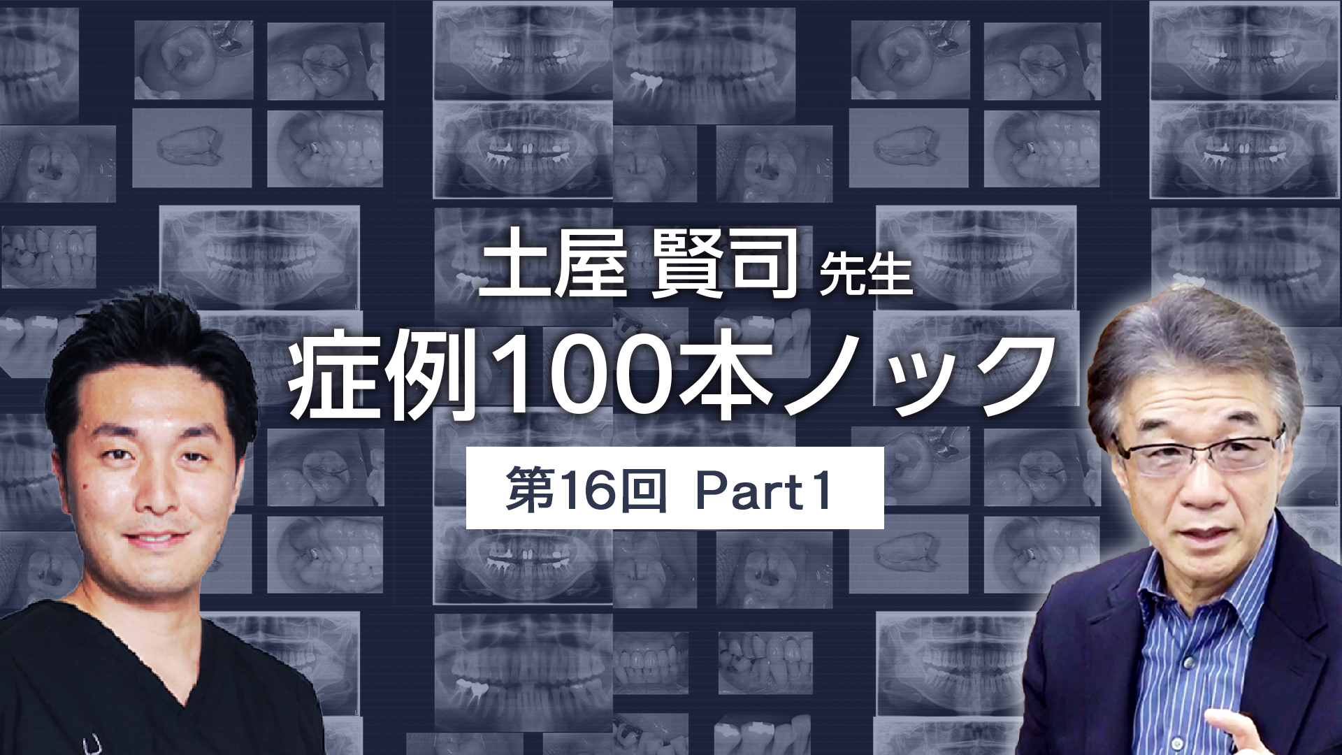 土屋賢司先生 症例100本ノック 第16回 PART1