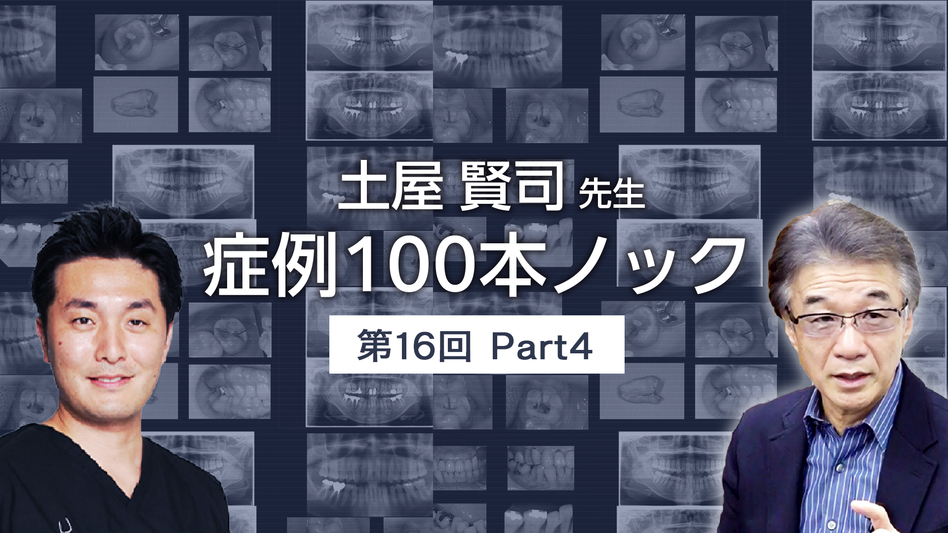 土屋賢司先生 症例100本ノック 第16回 PART4