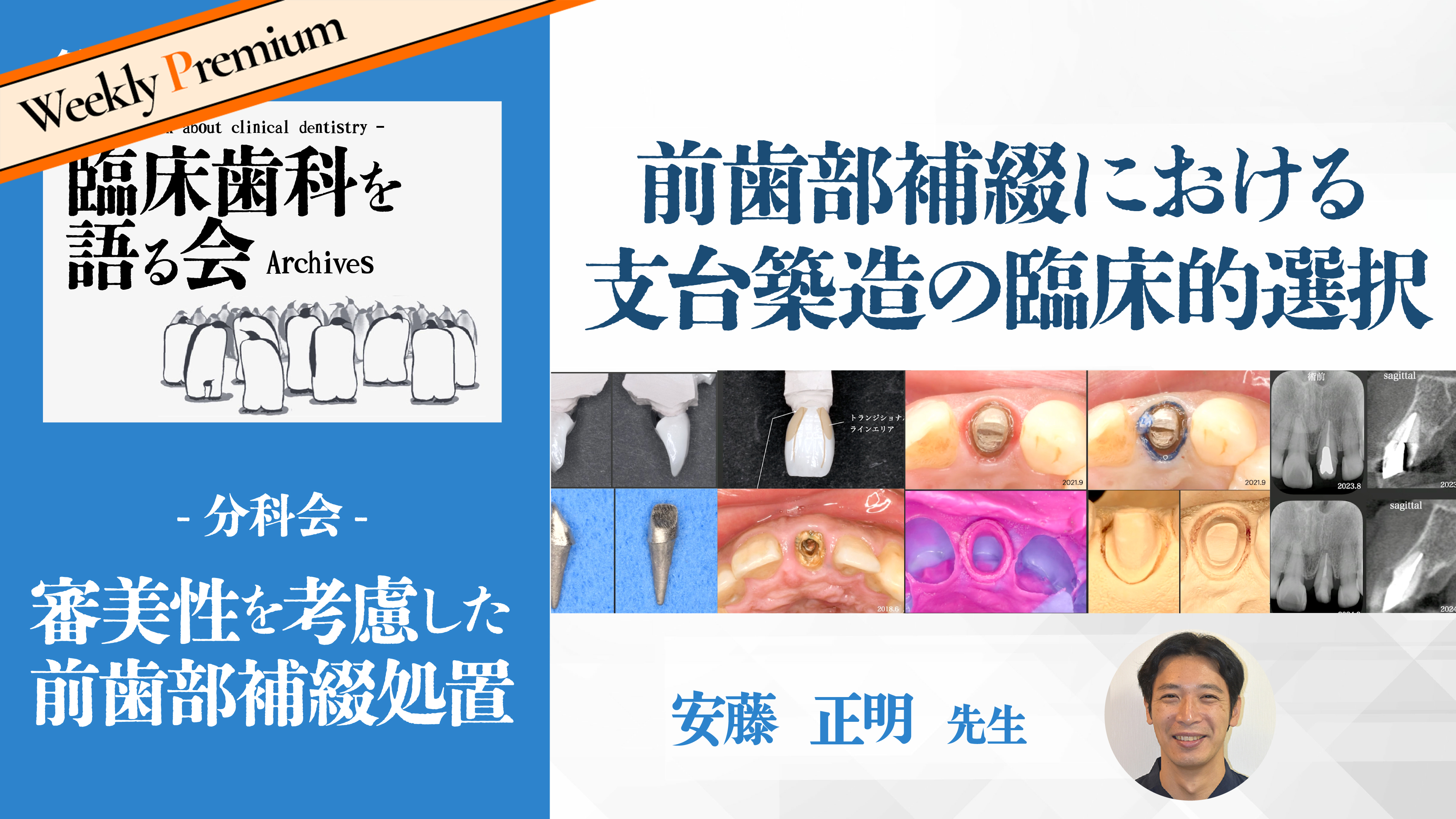 前歯部補綴における支台築造の臨床的選択|第43回 臨床歯科を語る会 分科会【審美性を考慮した前歯部補綴処置】【05/22-05/28 プレミアム化】