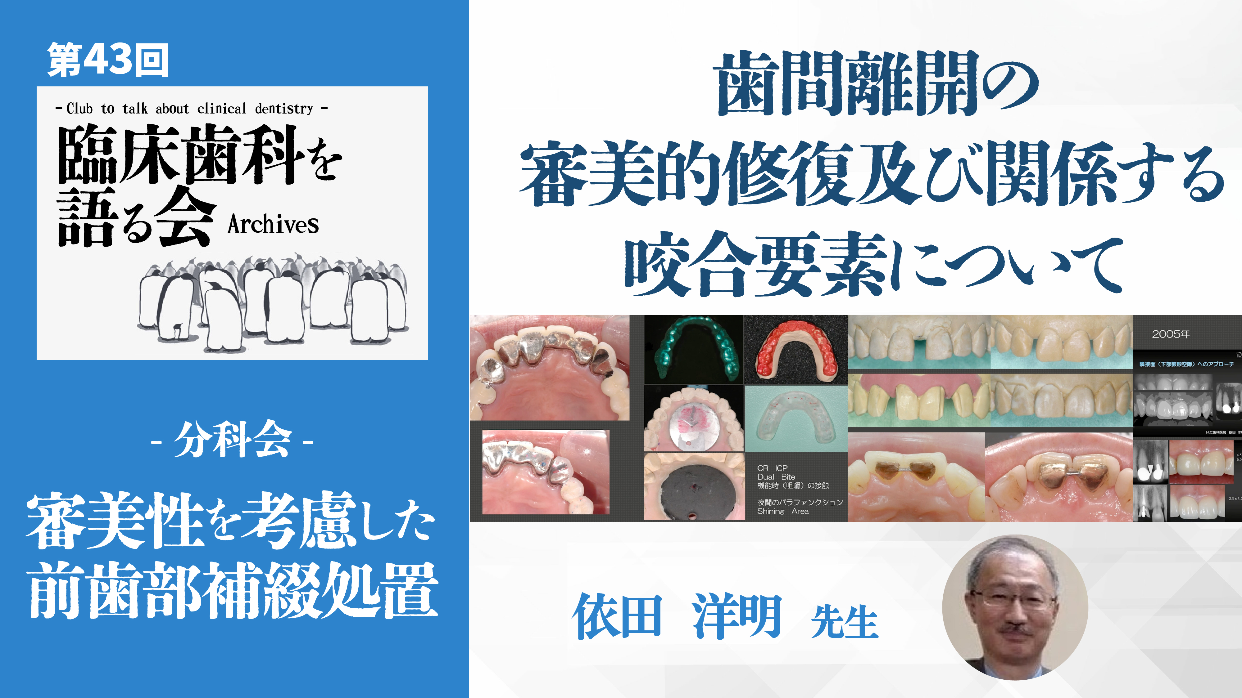 歯間離開の審美的修復及び関係する咬合要素について|第43回 臨床歯科を語る会 分科会【審美性を考慮した前歯部補綴処置】