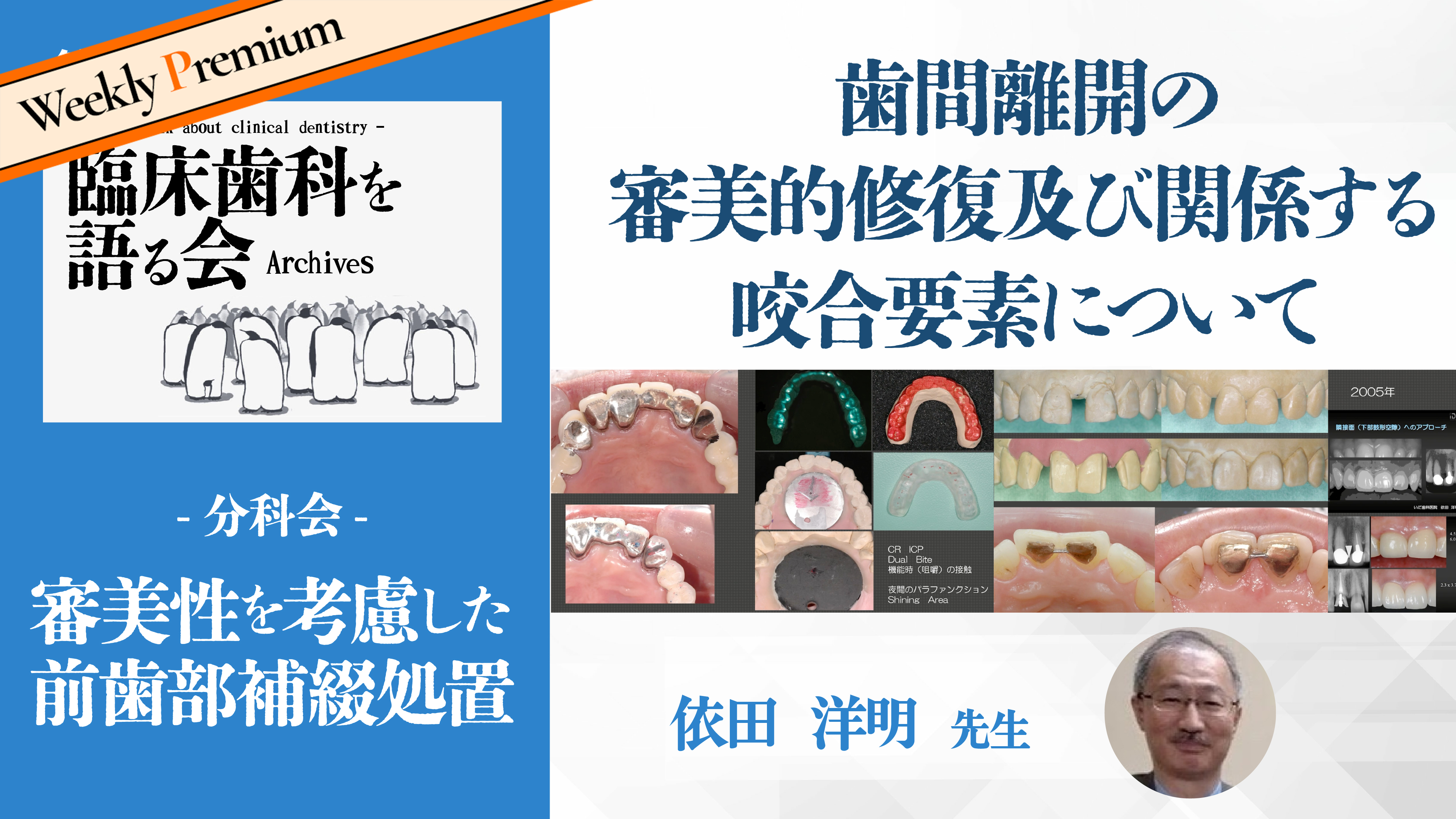 歯間離開の審美的修復及び関係する咬合要素について|第43回 臨床歯科を語る会 分科会【審美性を考慮した前歯部補綴処置】【05/29-06/04 プレミアム化】