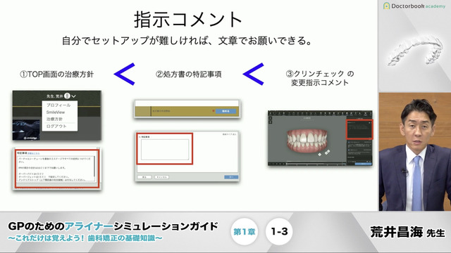 第1章 クリンチェックの特徴 GPのためのアライナー 