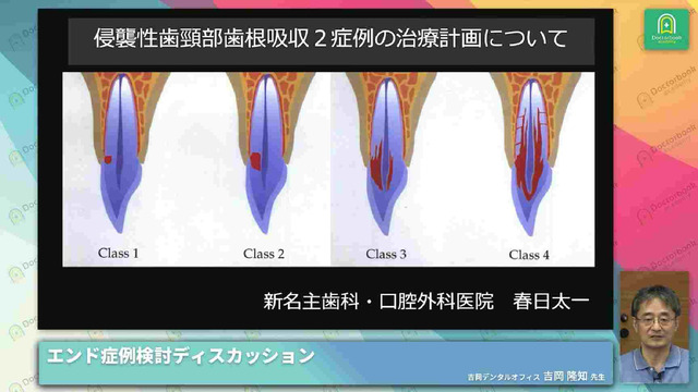 Endo Case Discussion NEXT - 若手ドクター×エンド専門医 症例 Endo Case Discussion NEXT - 若手ドクター×エンド専門医 症例